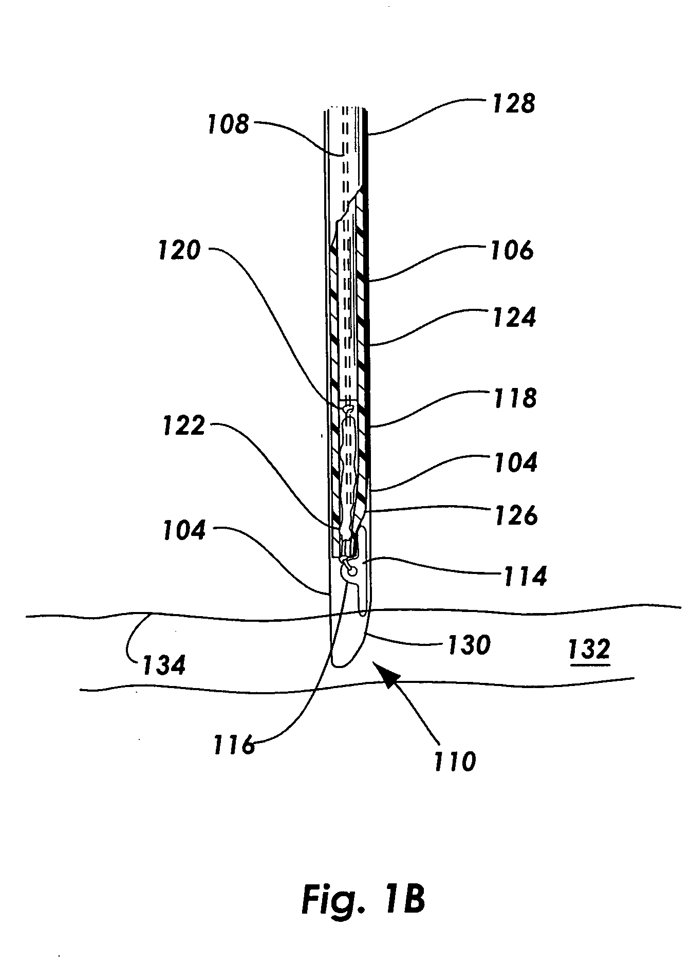 Vascular sealing device with high surface area sealing plug