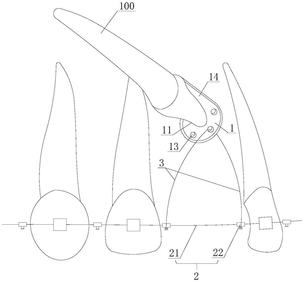 A traction device for horizontal high impacted central incisors