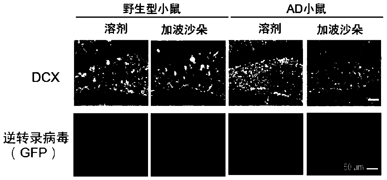 Application of gaboxadol to preparation of medicine for treating alzheimer's disease and pharmaceutical composition