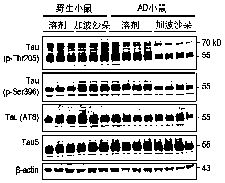 Application of gaboxadol to preparation of medicine for treating alzheimer's disease and pharmaceutical composition