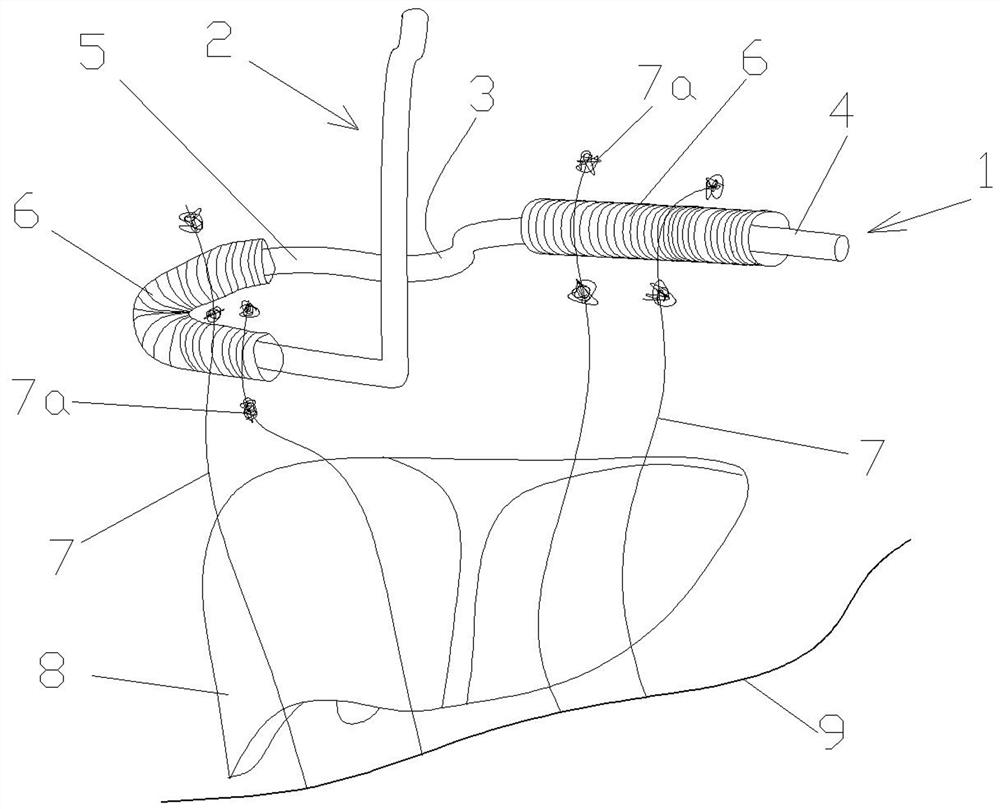 Device for exposing upper abdomen in laparoscopic surgery