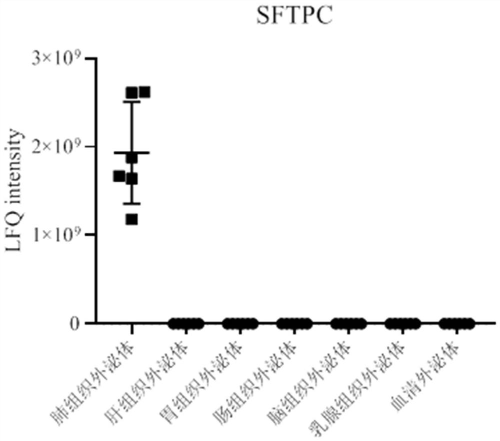 Application and kit of protein sftpc as a diagnostic marker for lung cancer
