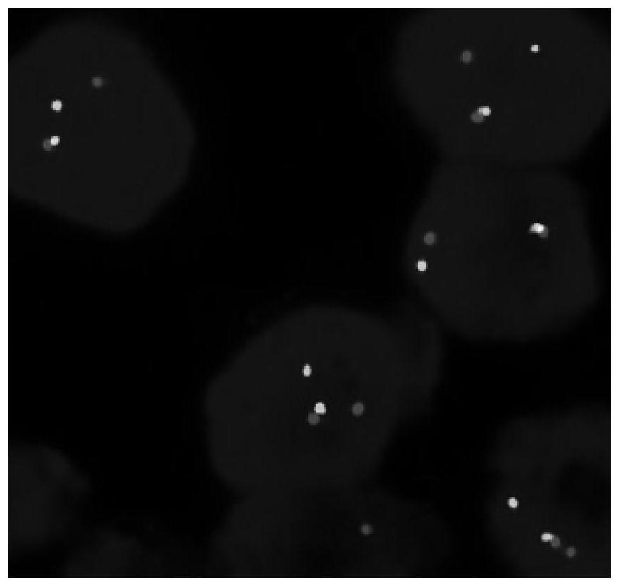 A kind of fish probe set and application thereof for detecting ntrk fusion