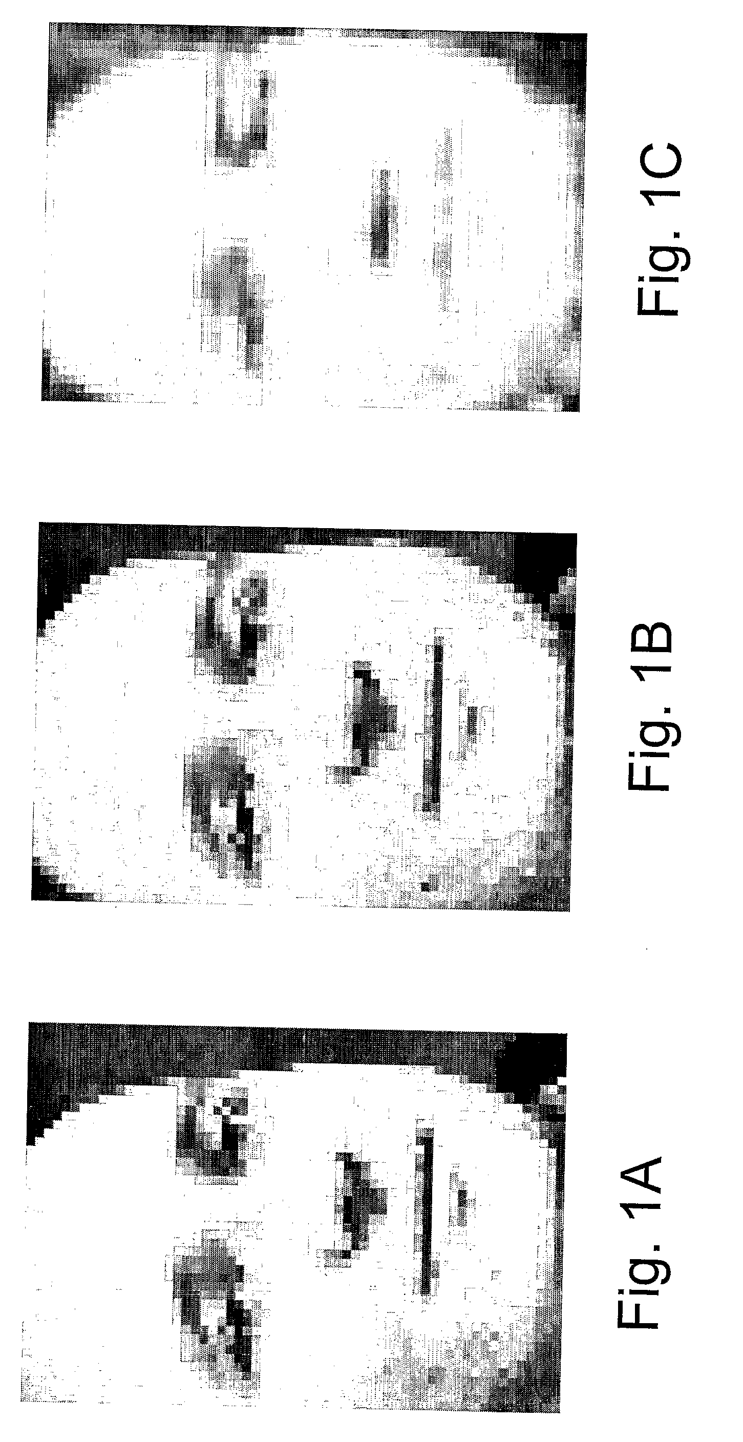 Face Normalization for Recognition and Enrollment