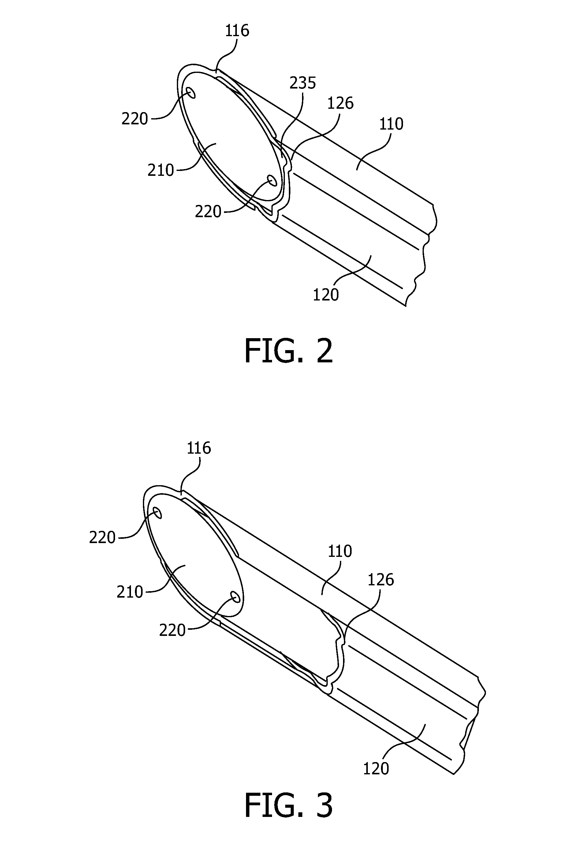 Splittable needle with fiber probe