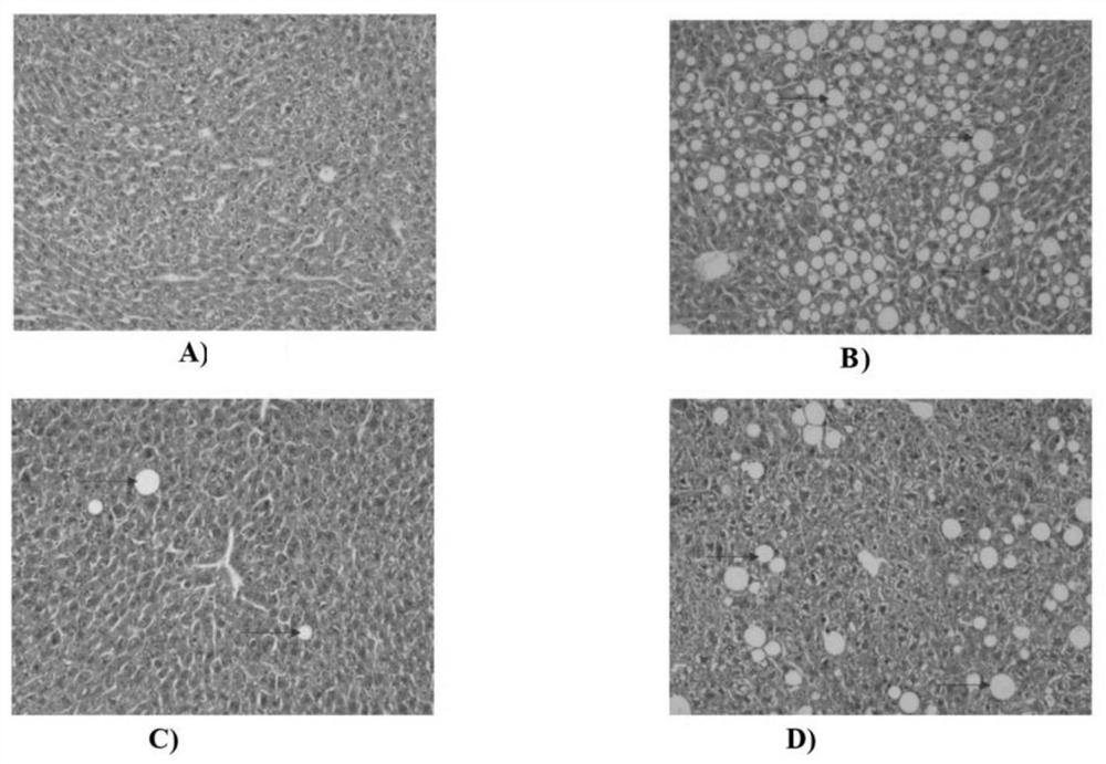 Application of tremella polysaccharide in preparation of preparation with effect of preventing and treating non-alcoholic fatty liver disease