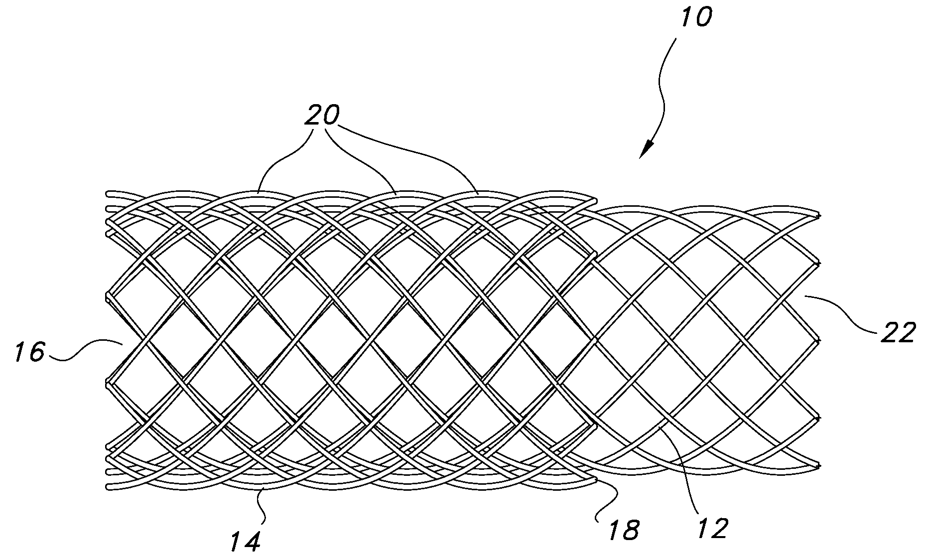 Continuous double layered stent for migration resistance