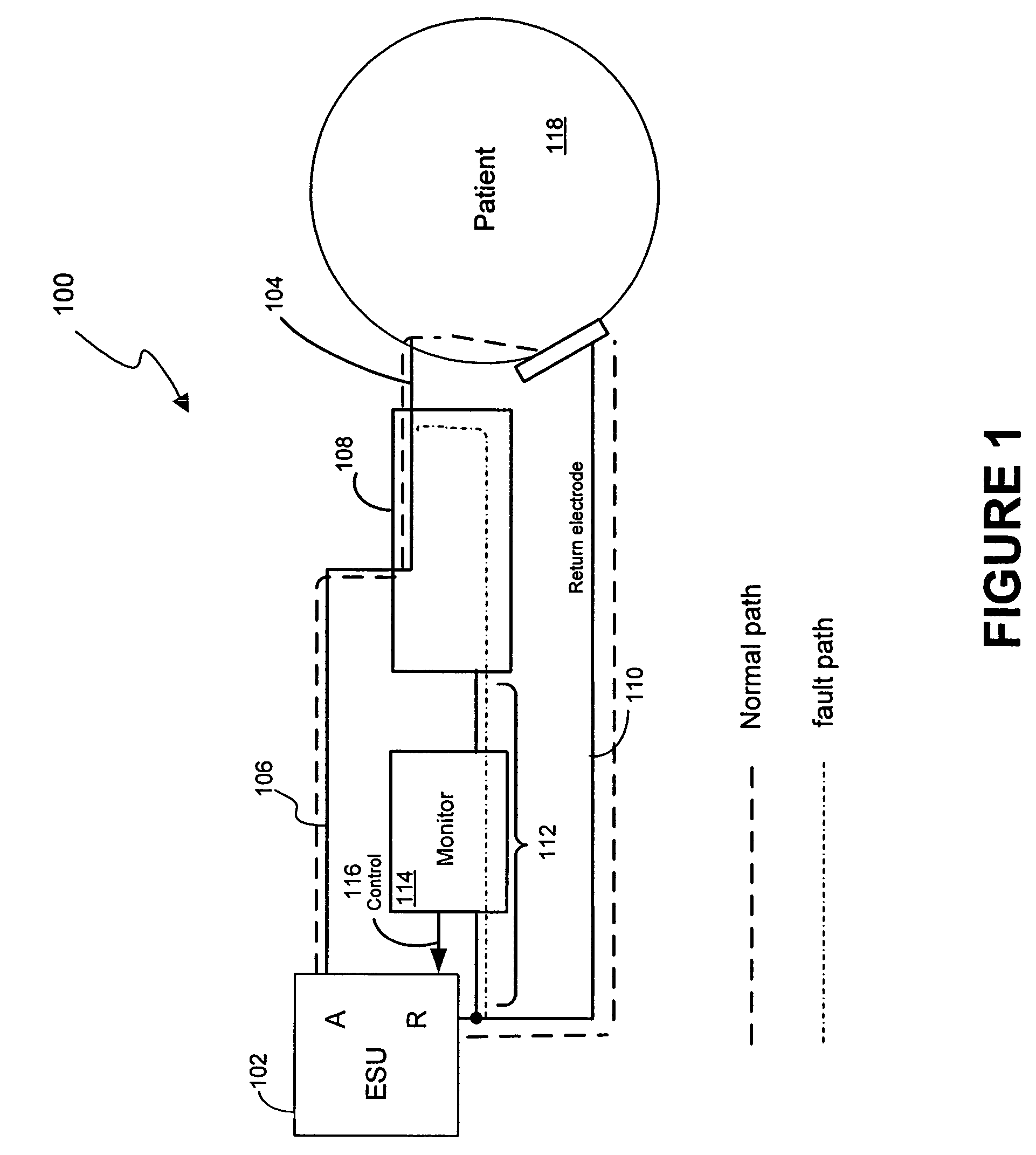 System and method for performing an electrosurgical procedure