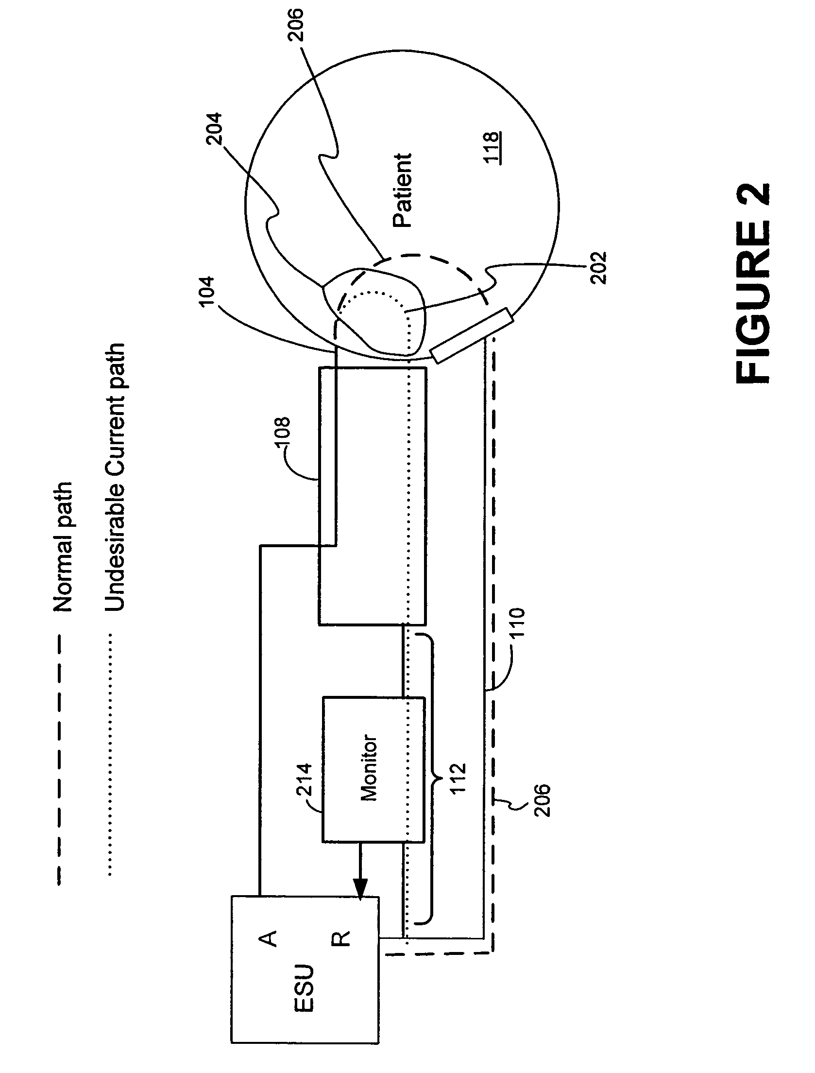 System and method for performing an electrosurgical procedure