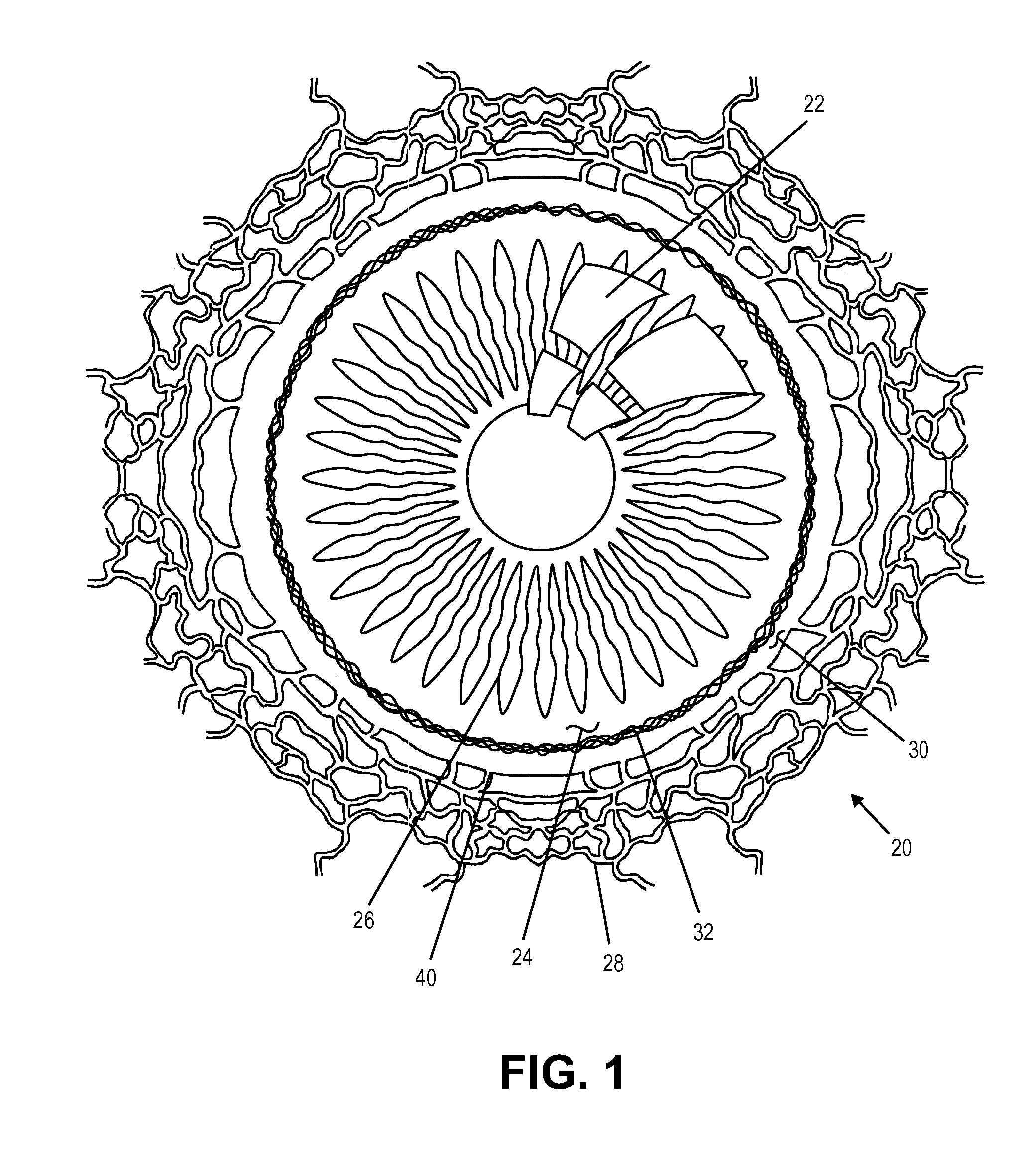 Single Operator Device for Delivering an Ocular Implant