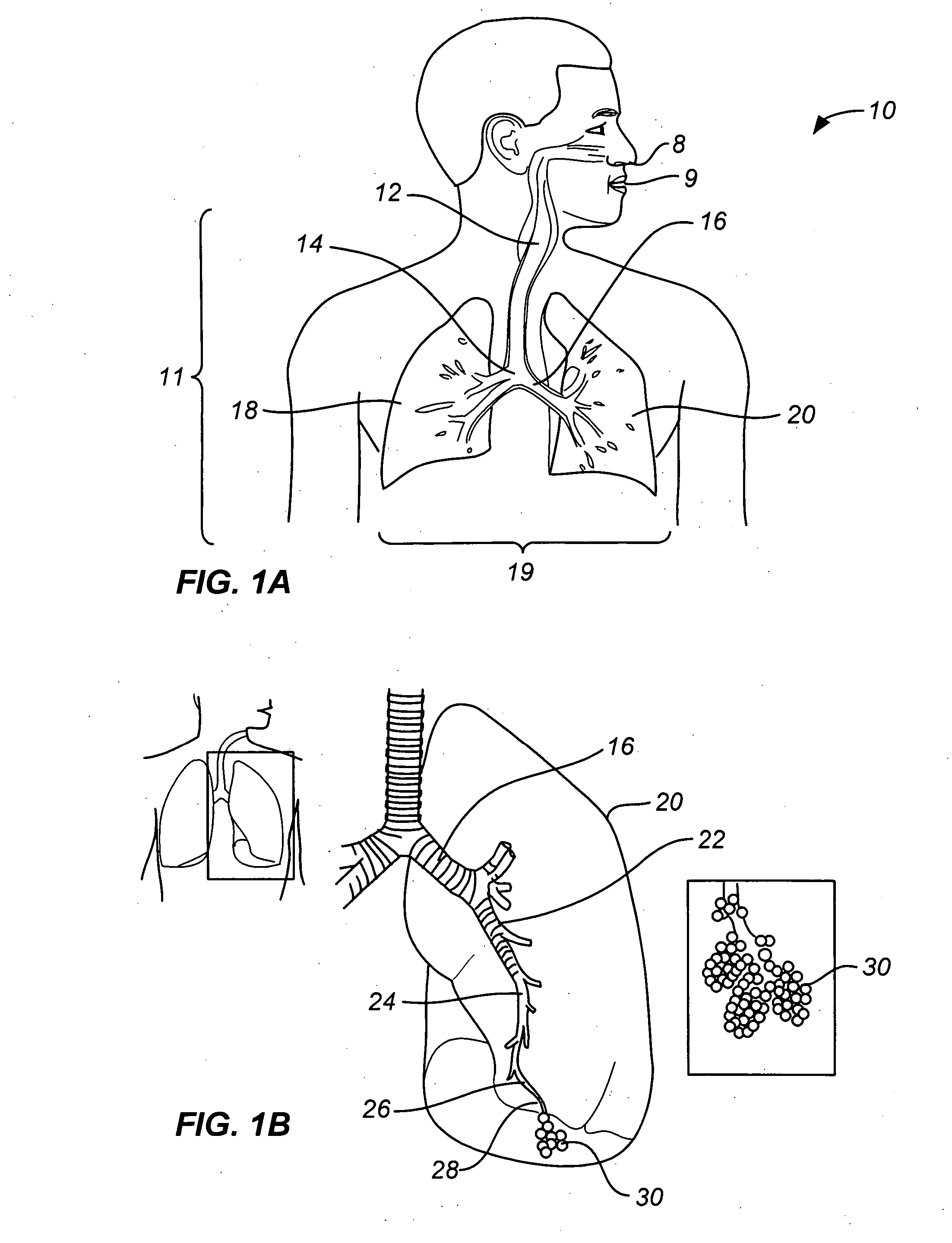 Steerable device for accessing a target site and methods