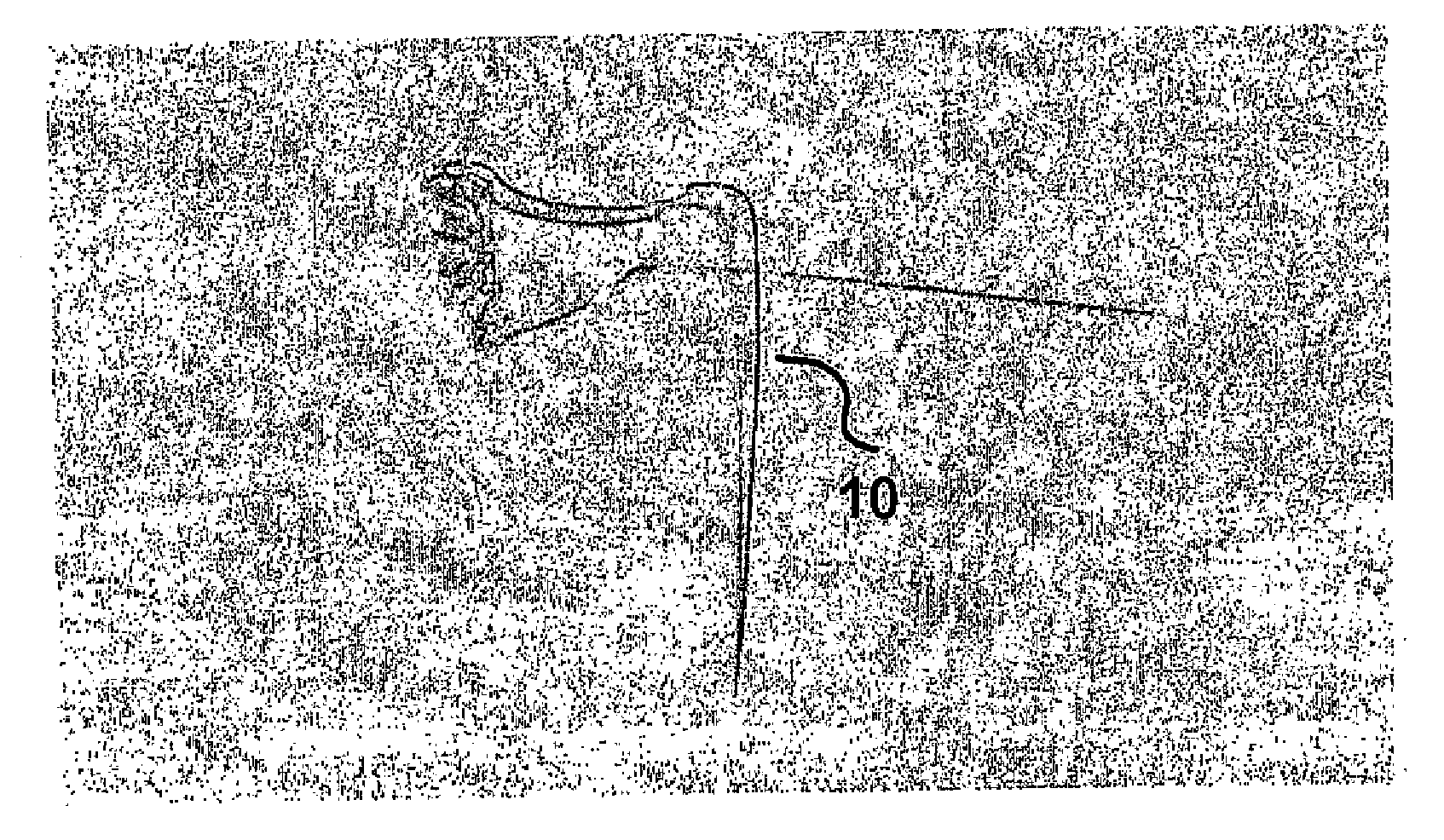 Method and device for the controlled delivery and placement of securing elements in a body