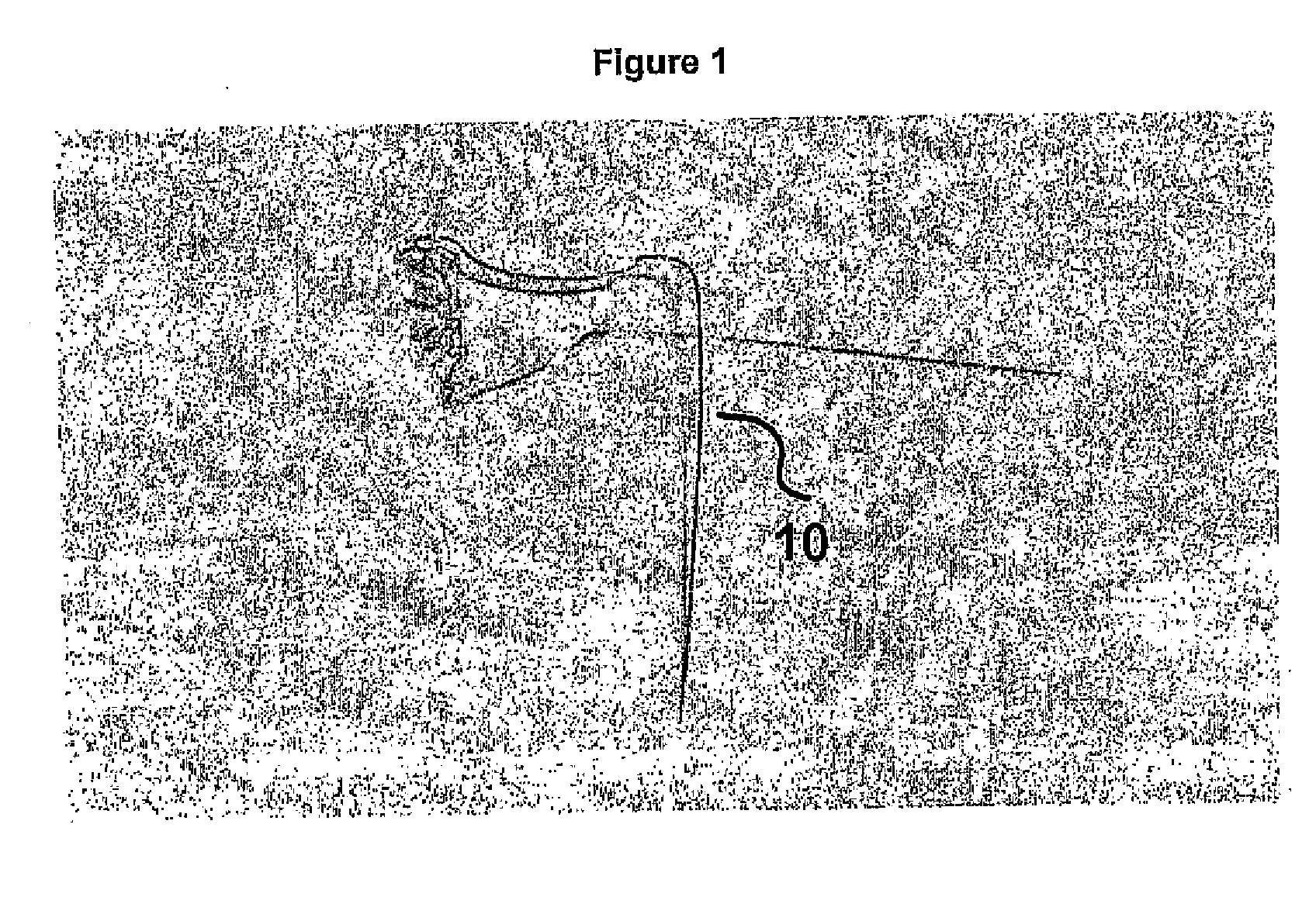 Method and device for the controlled delivery and placement of securing elements in a body