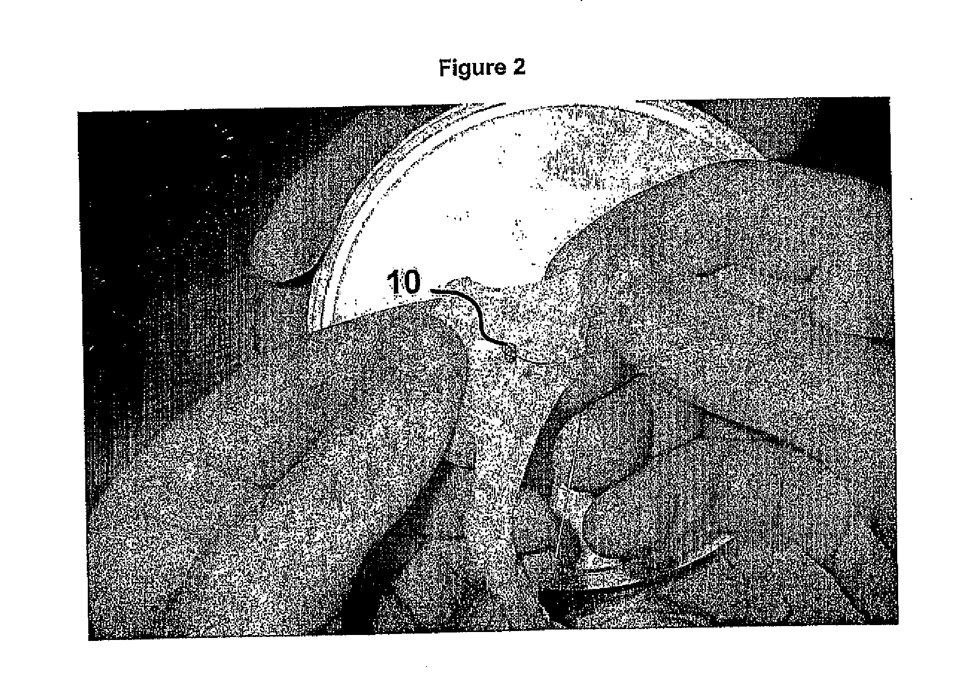 Method and device for the controlled delivery and placement of securing elements in a body