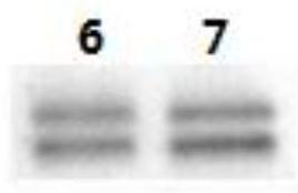 Phosphorylated antigen polypeptide, phosphorylated antibody and preparation method for phosphorylated antigen antibody
