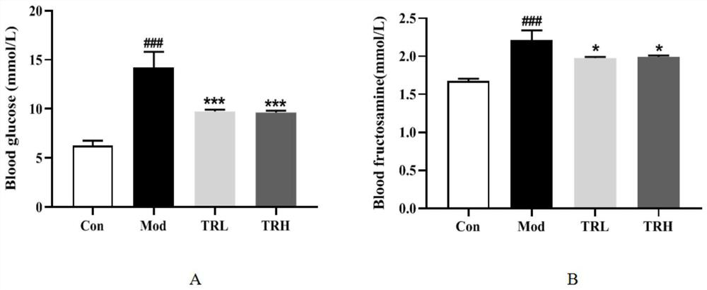 Application of trilobatin in preparation of medicine for preventing and/or treating non-alcoholic fatty liver disease