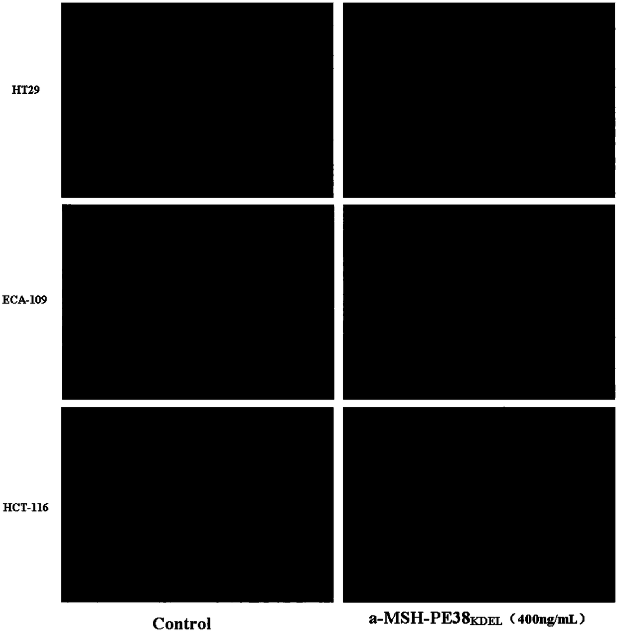 Application of melanotropin hormone recombinant toxin in preparation drugs treating colon cancer