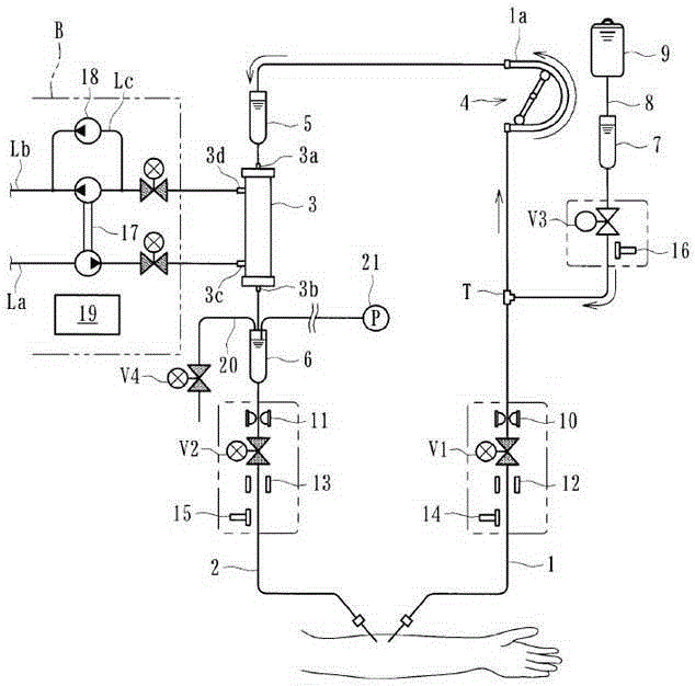 blood purification device