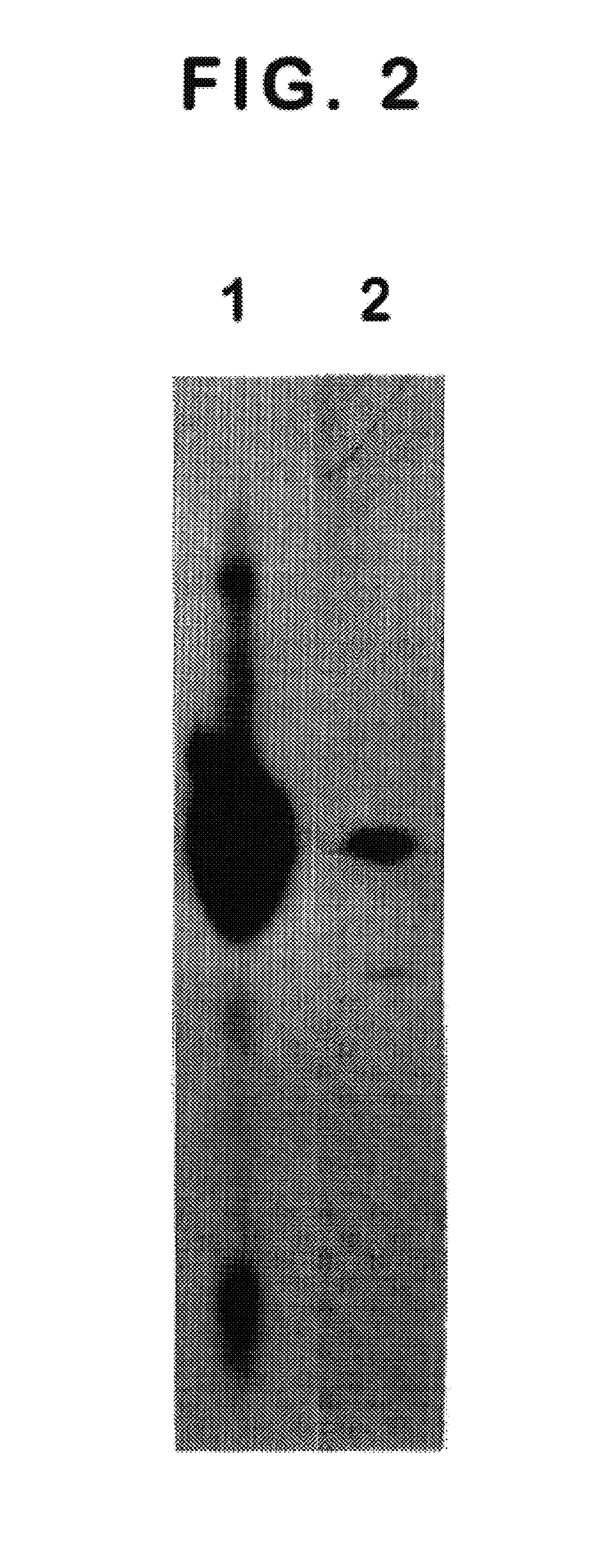 Monoclonal antibody specific for the extracellular domain of prostate specific membrane antigen