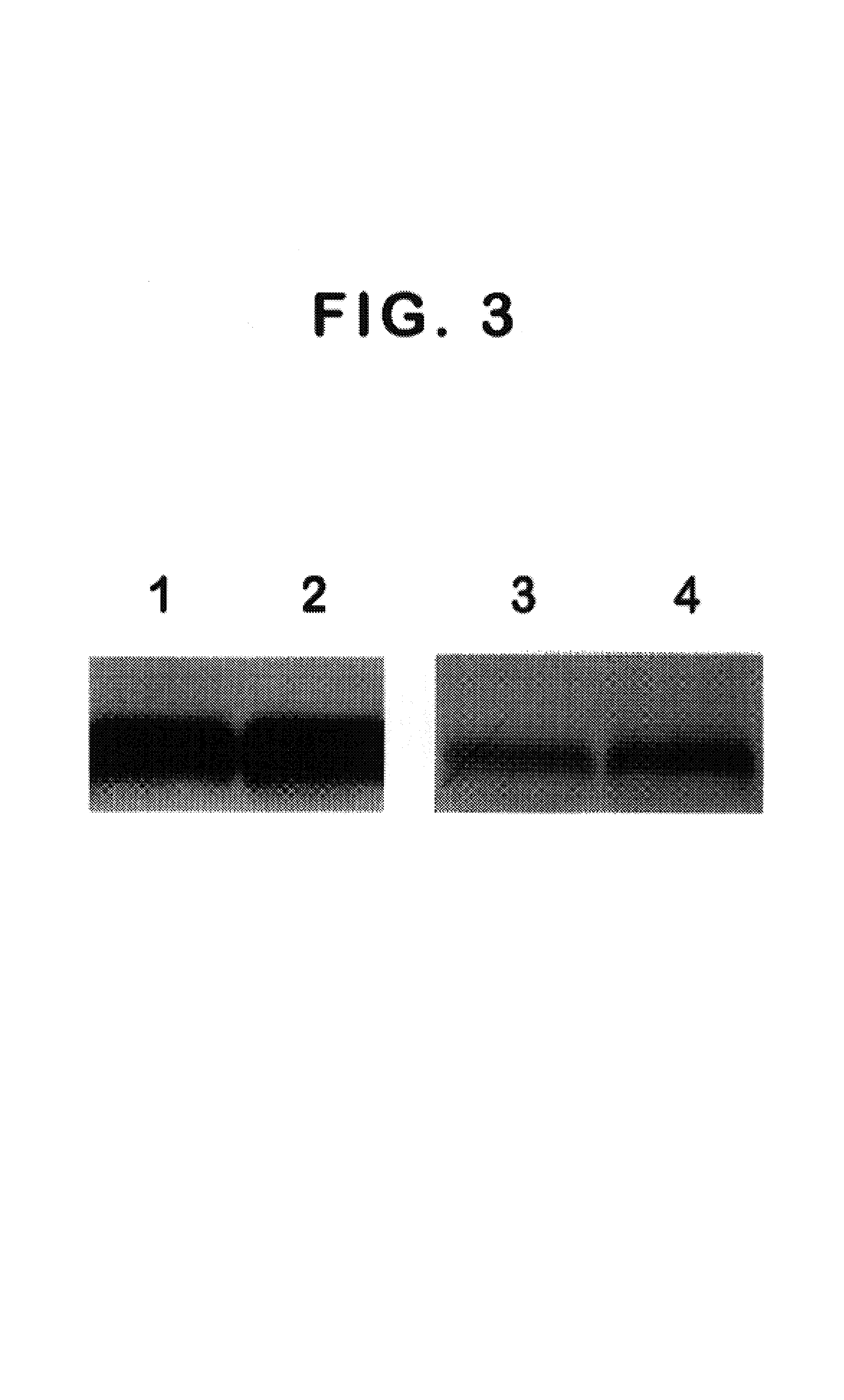 Monoclonal antibody specific for the extracellular domain of prostate specific membrane antigen