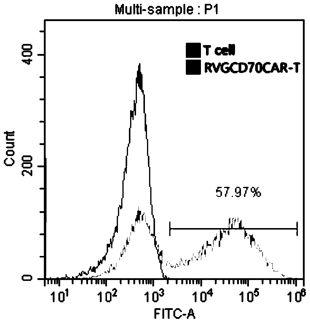 RVG-CD70 CAR-T cells and preparation method and application thereof