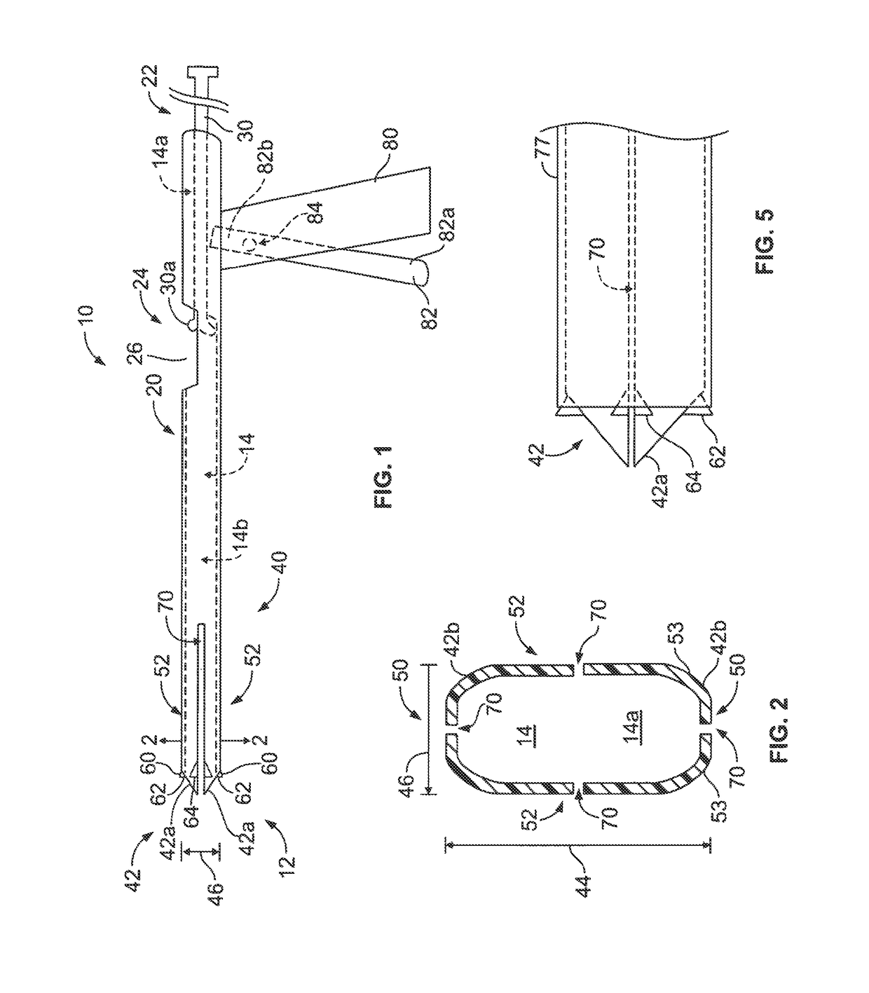 Configurable intervertebral implant