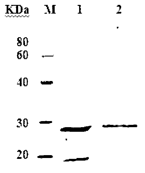 Application of protein and composition thereof in preparation of product used for preventing, diagnosing or treating EHEC (Enterohemorrhagic Escherichia Coli) infection