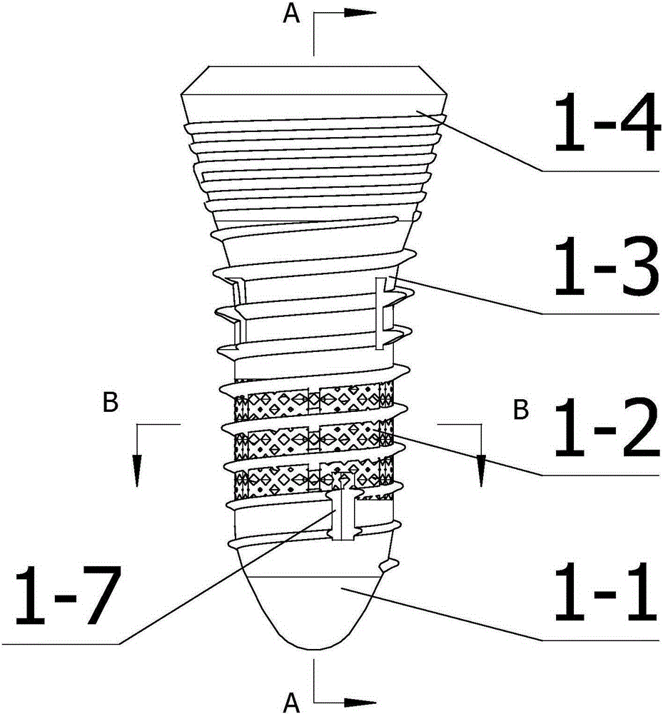 Multi-section implant assembly and manufacturing method thereof
