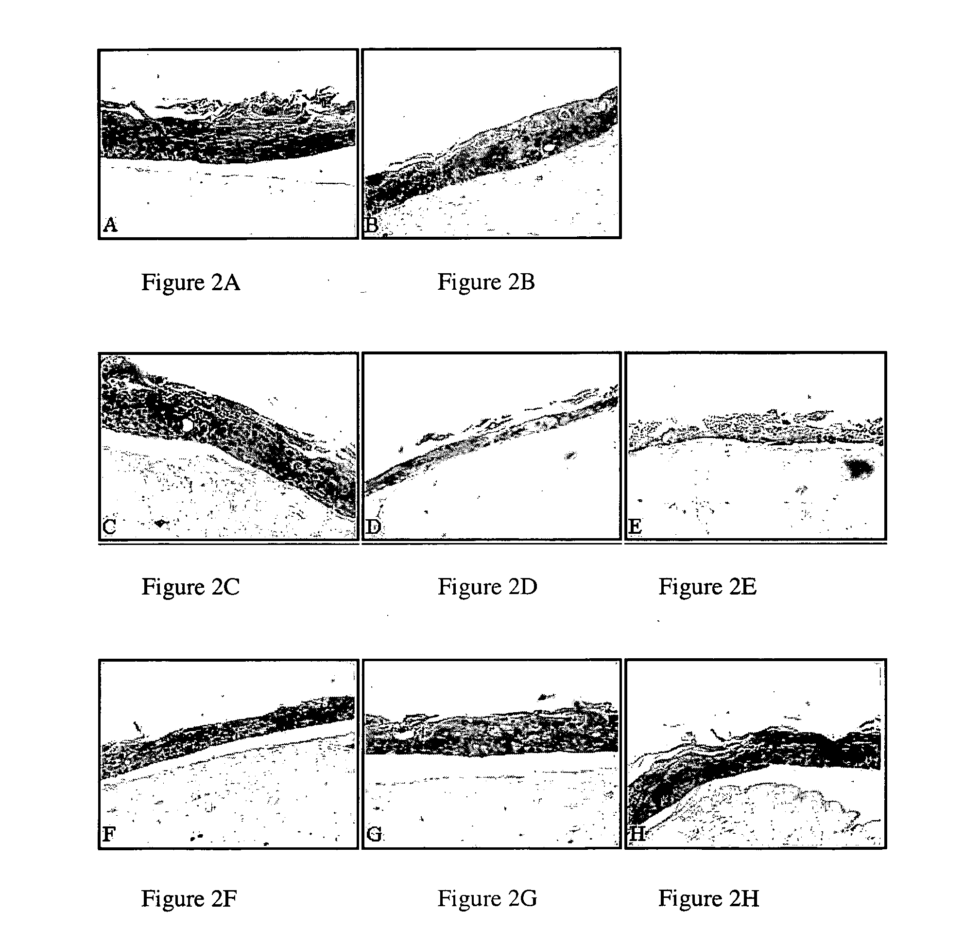 Compositions and methods for inhibiting abnormal cell growth