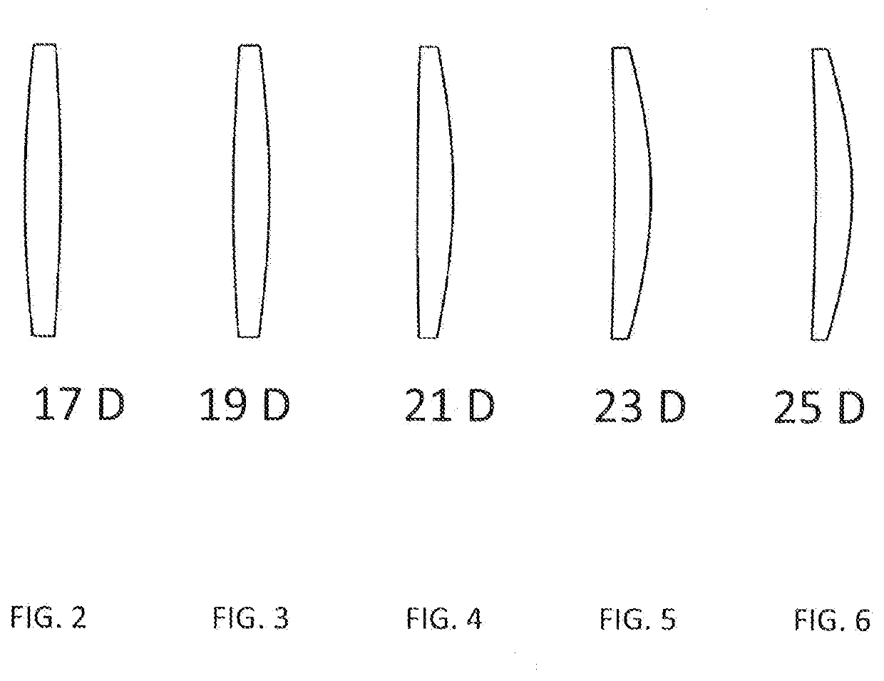 Novel intraocular lens for extended macular vision in patients with macular degeneration