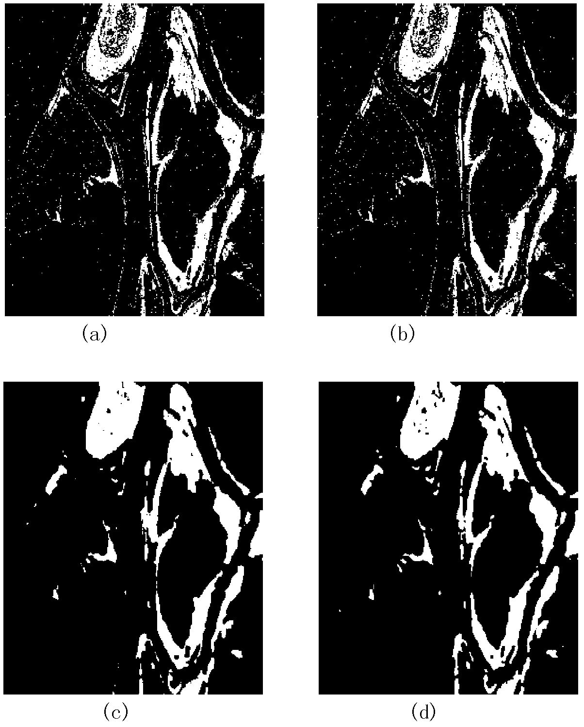 SAR (Specific Absorption Rate) image change detection method based on space approach degree and pixel similarity