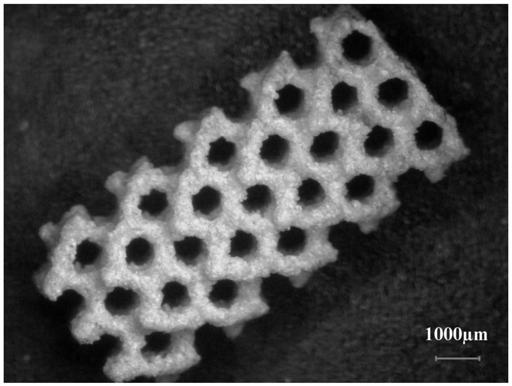 Forming method and product of polyetheretherketone biophilic metal porous bone implant