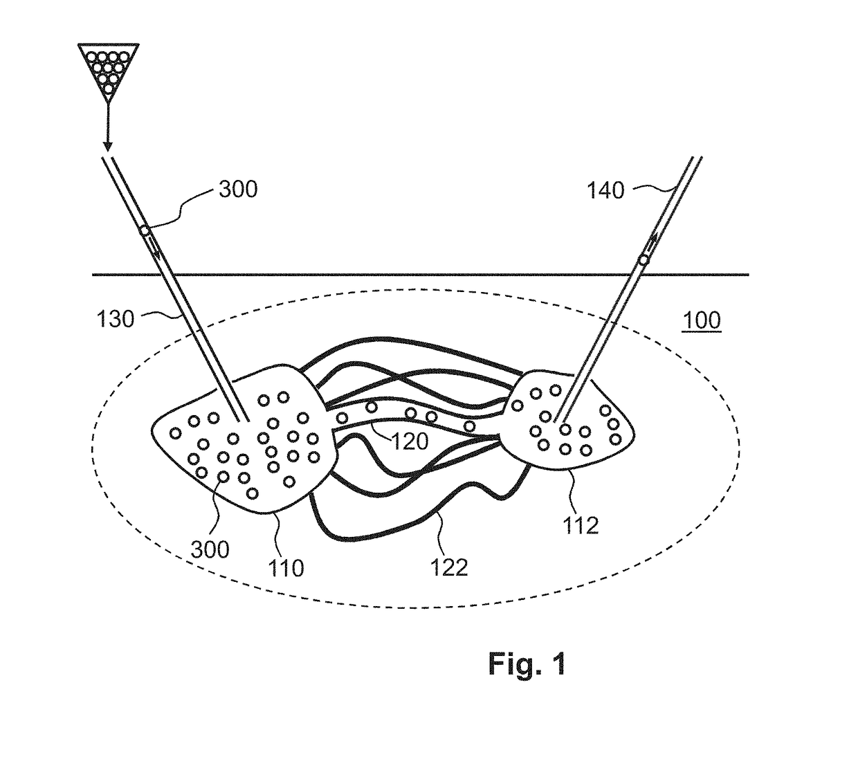 Sensor system, mote and a motes-system for sensing an environmental parameter