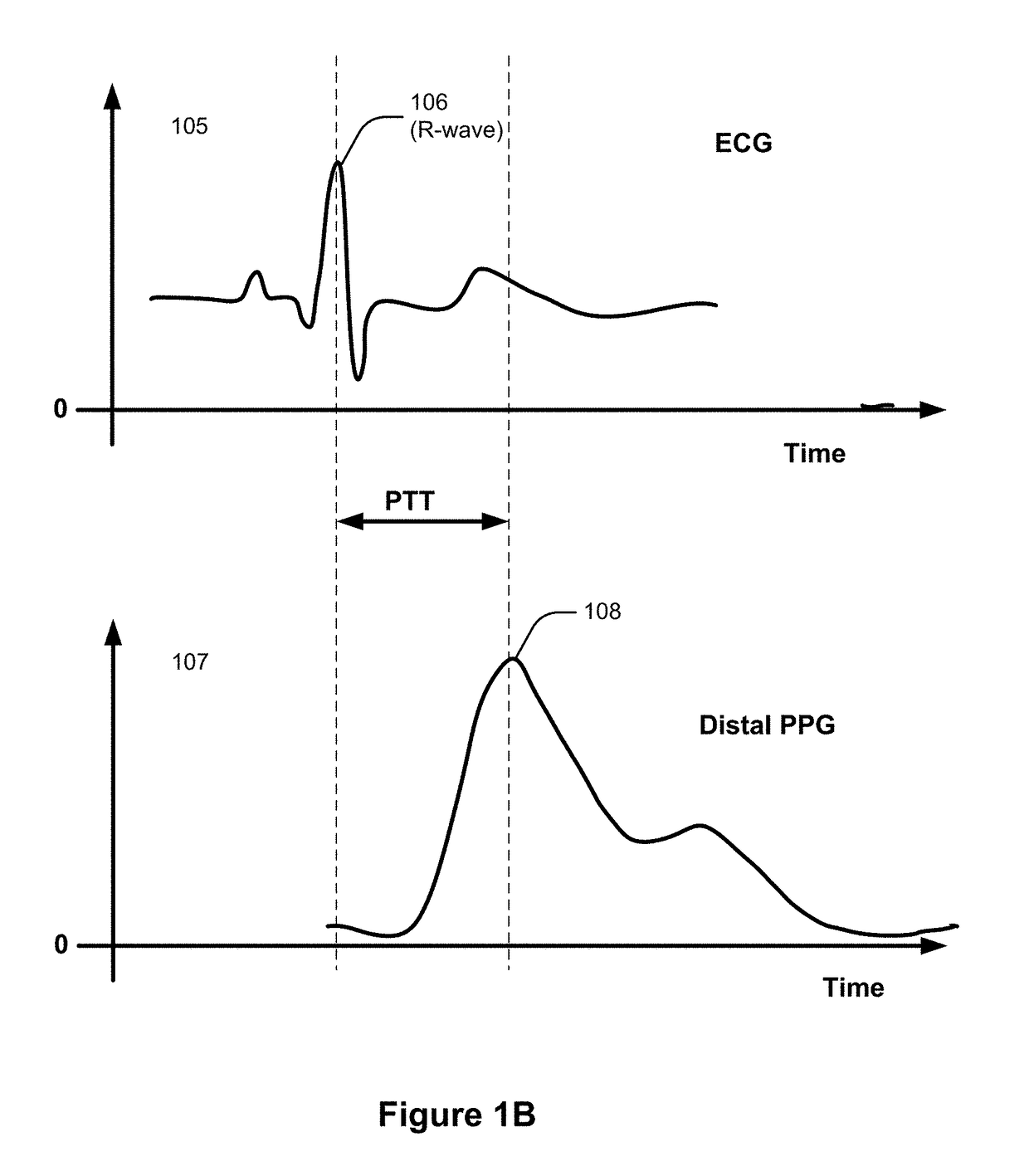 Calibration of pulse-transit-time to blood pressure model using multiple physiological sensors and various methods for blood pressure variation