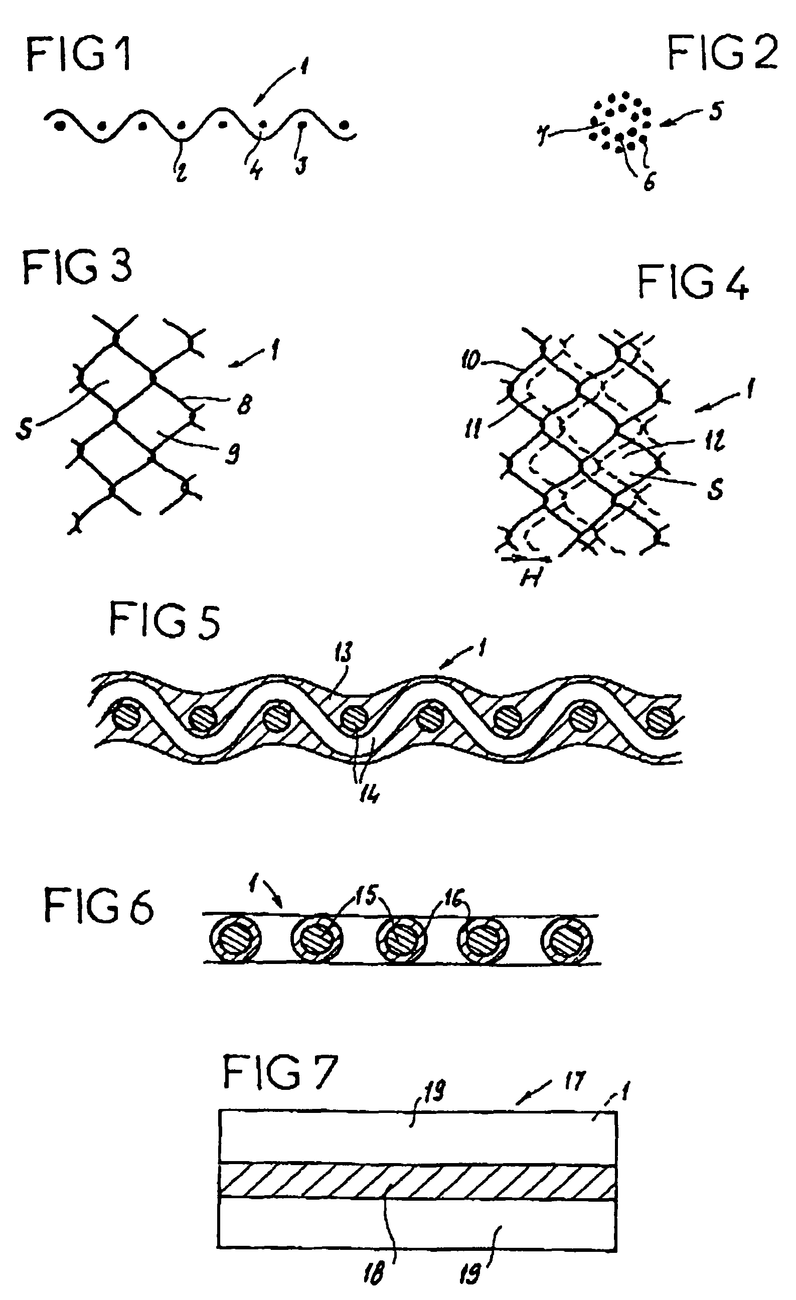 Prosthesis for reinforcement of tissue structures