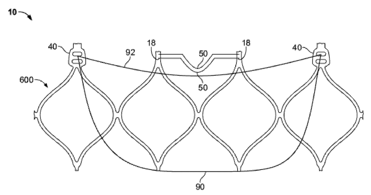 Transcatheter valve stent anchors