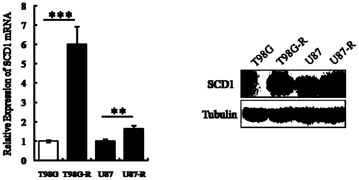 Application of scd1, a marker molecule for detection of drug resistance of glioma temozolomide