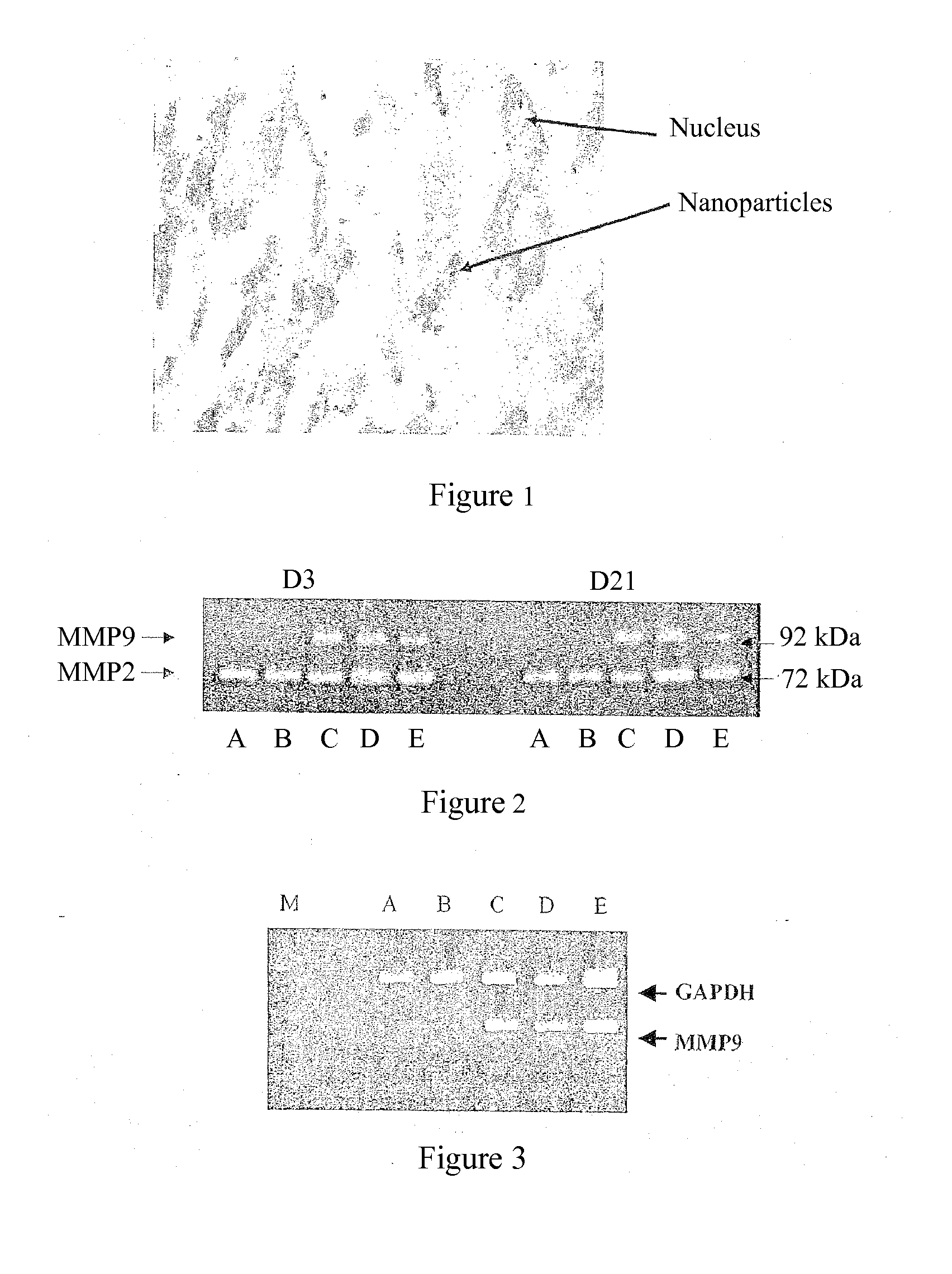 Use of gingival fibroblasts for vascular cell therapy