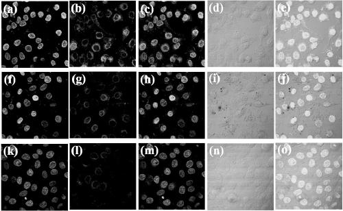 Core-shell magnetic composite particle coated with phosphorylcholine-containing polymer and preparation method thereof