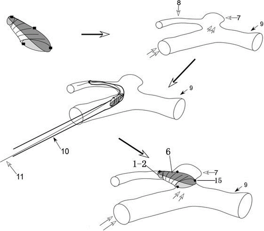 A stent for blocking arterial aneurysm of an initial part of an arterial branch and application thereof