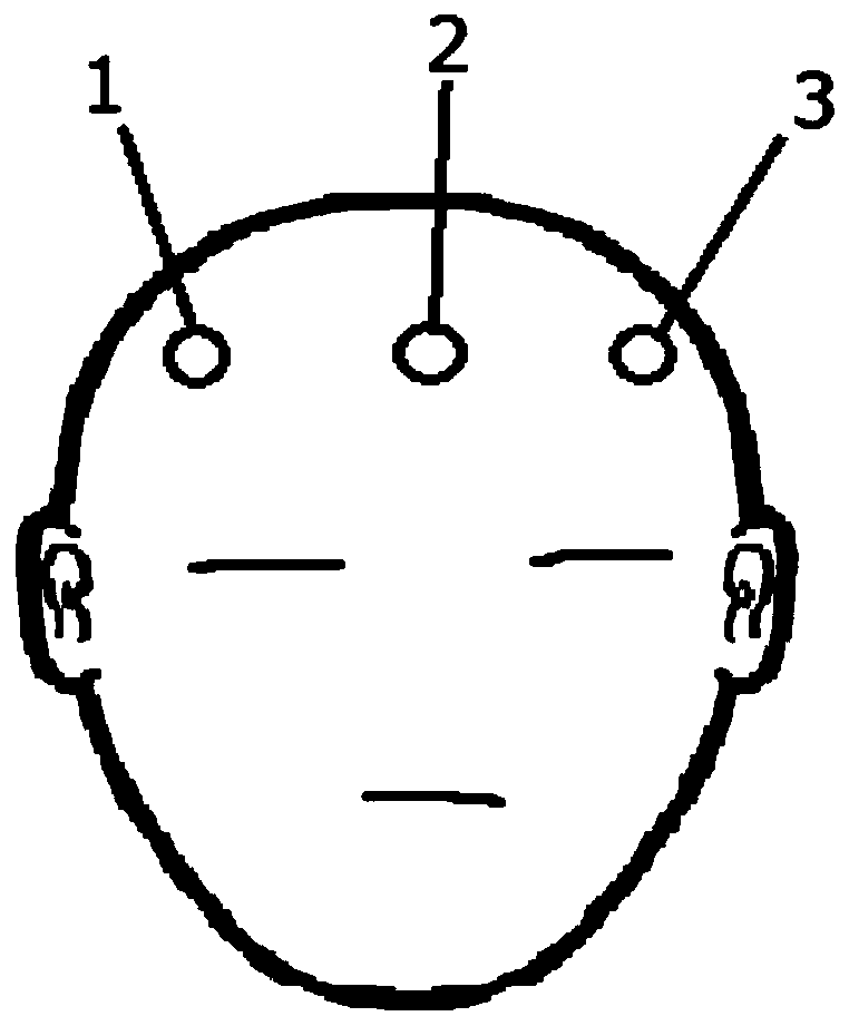 Wearable driver anti-fatigue intelligent monitoring and early warning system based on EEG