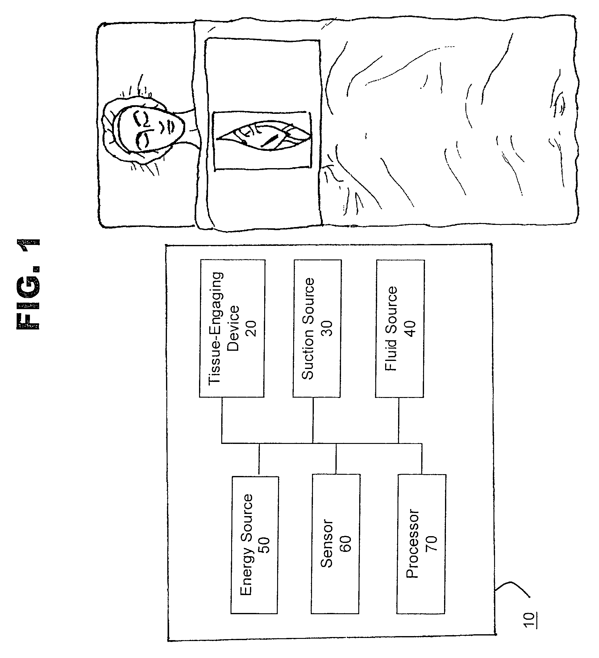 Method and system for organ positioning and stabilization