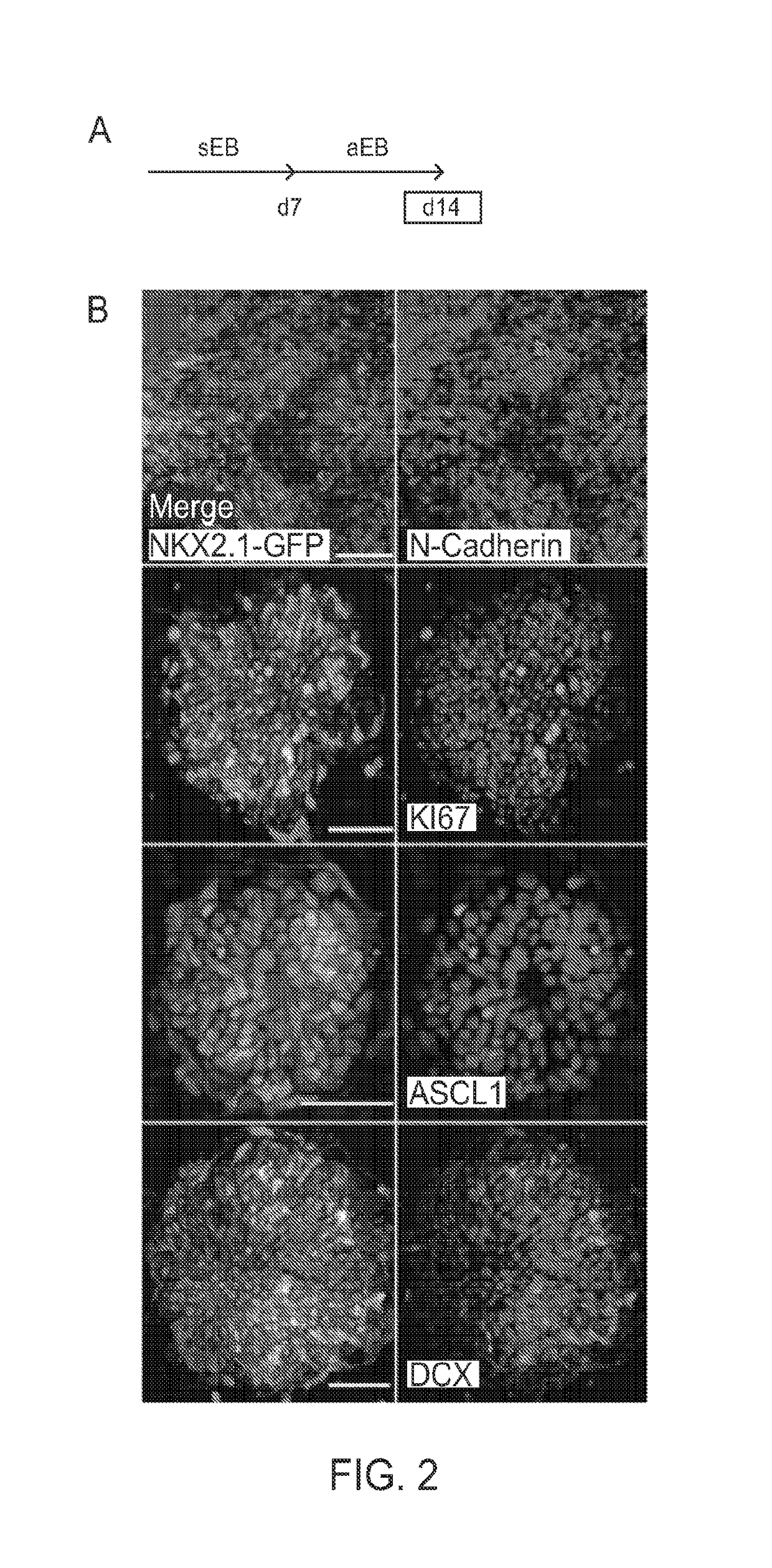In vitro production of medial ganglionic eminence precursor cells