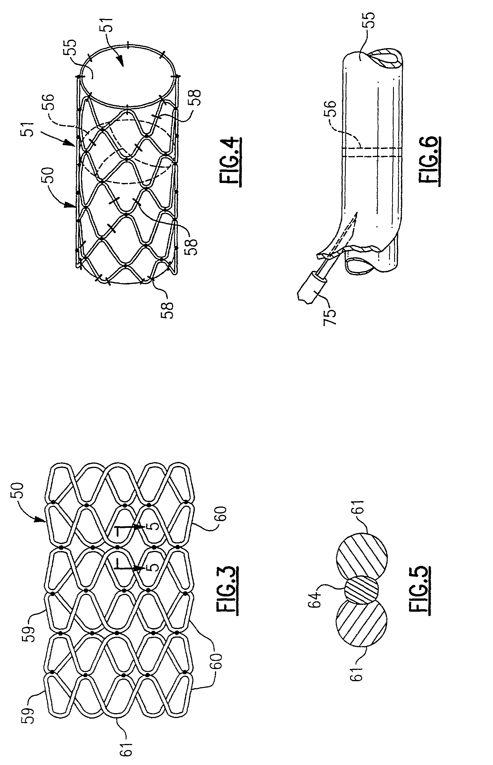 System for implanting a replacement valve