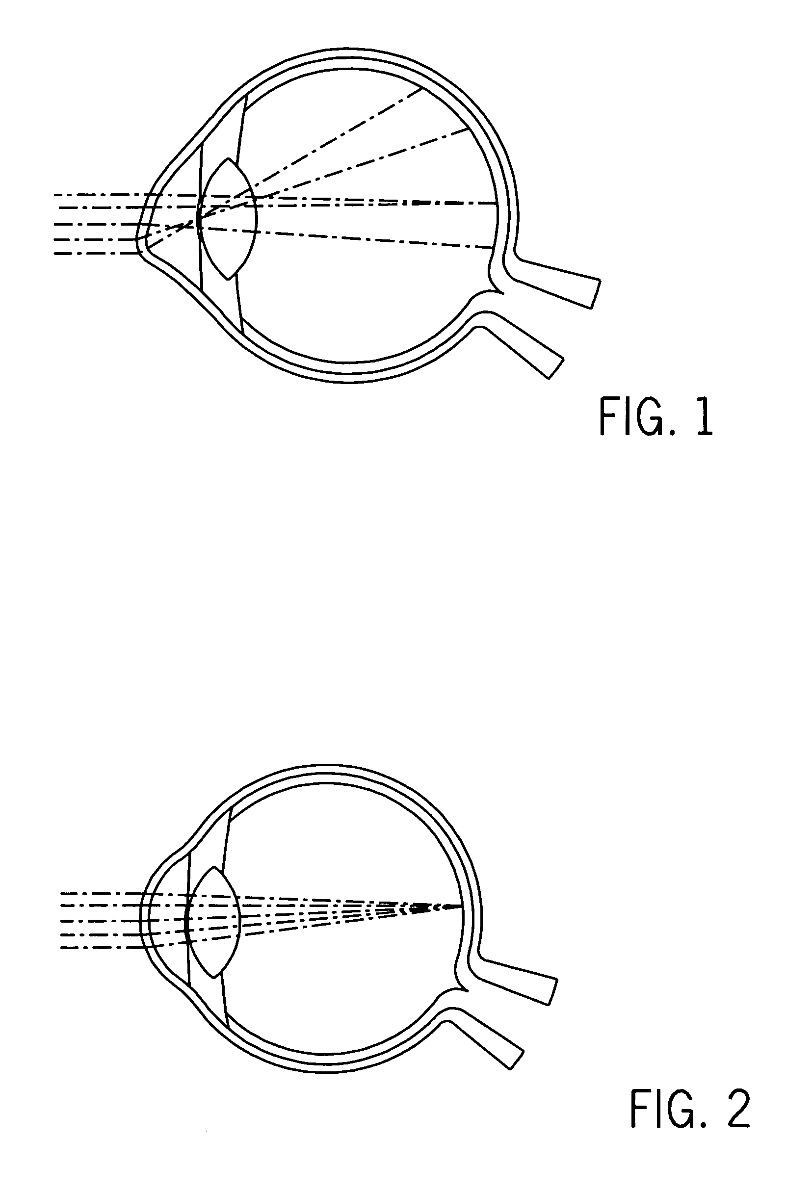 Pre-formed intrastromal corneal insert for corneal abnormalities or dystrophies