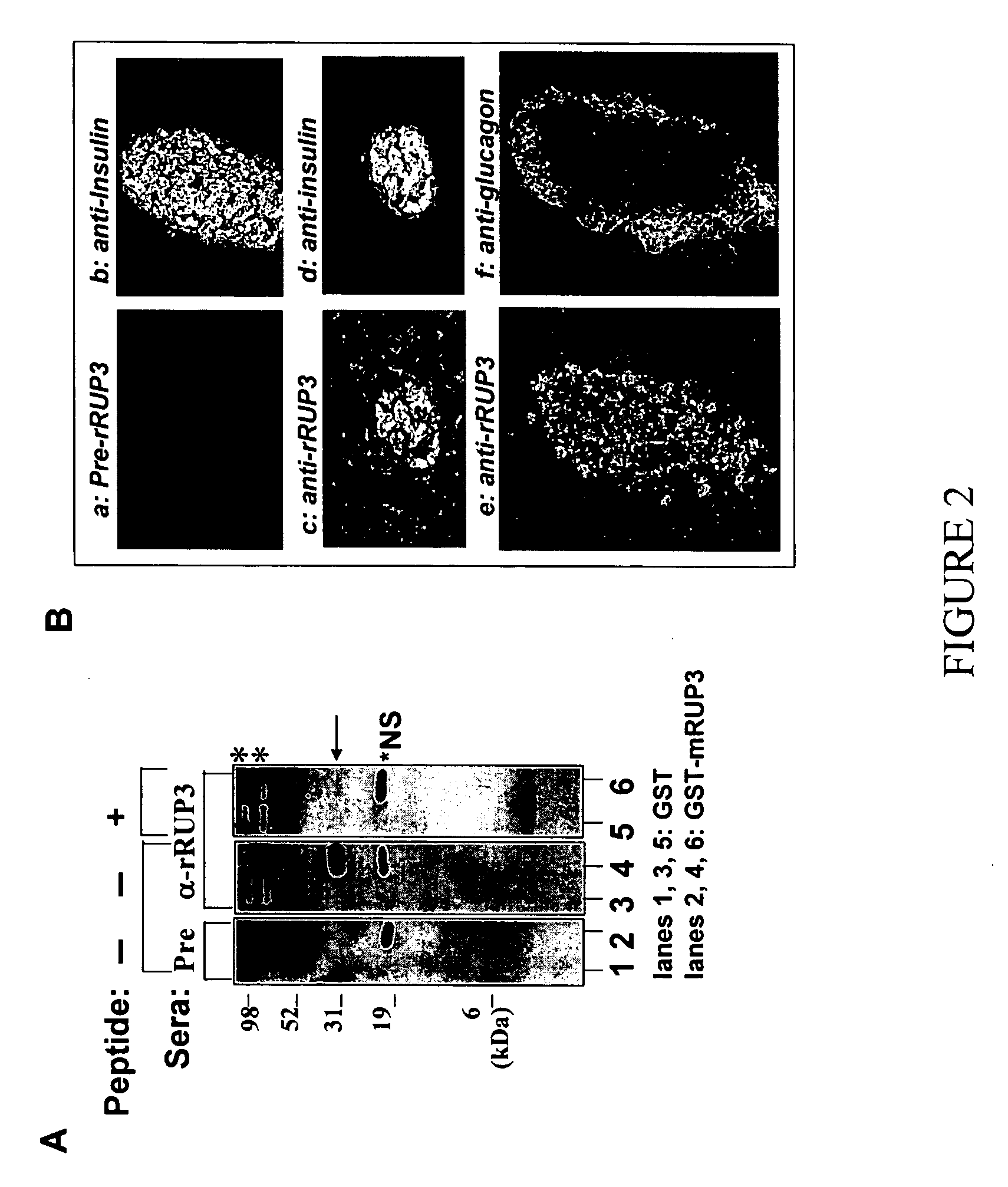 Substituted pyrindinyl and pyrimidinyl derivatives as modulators of metabolism and the treatment of disorders related thereto