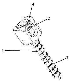 Carbon fiber pedicle screw and manufacturing method thereof