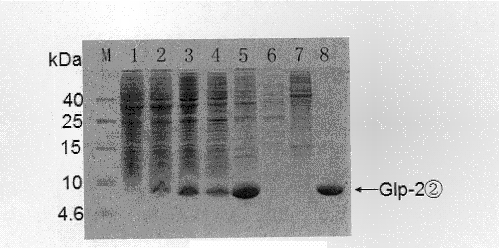 Two series major vault protein of glucagon-like peptide-2 of people and preparation method thereof