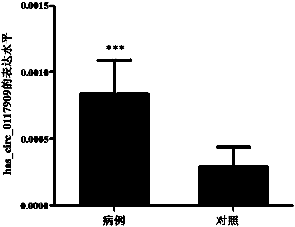 Group of circular RNA (circRNA) markers for diagnosis of childhood acute lymphoblastic leukemia (ALL) and application of group of circRNA markers for diagnosis of childhood ALL