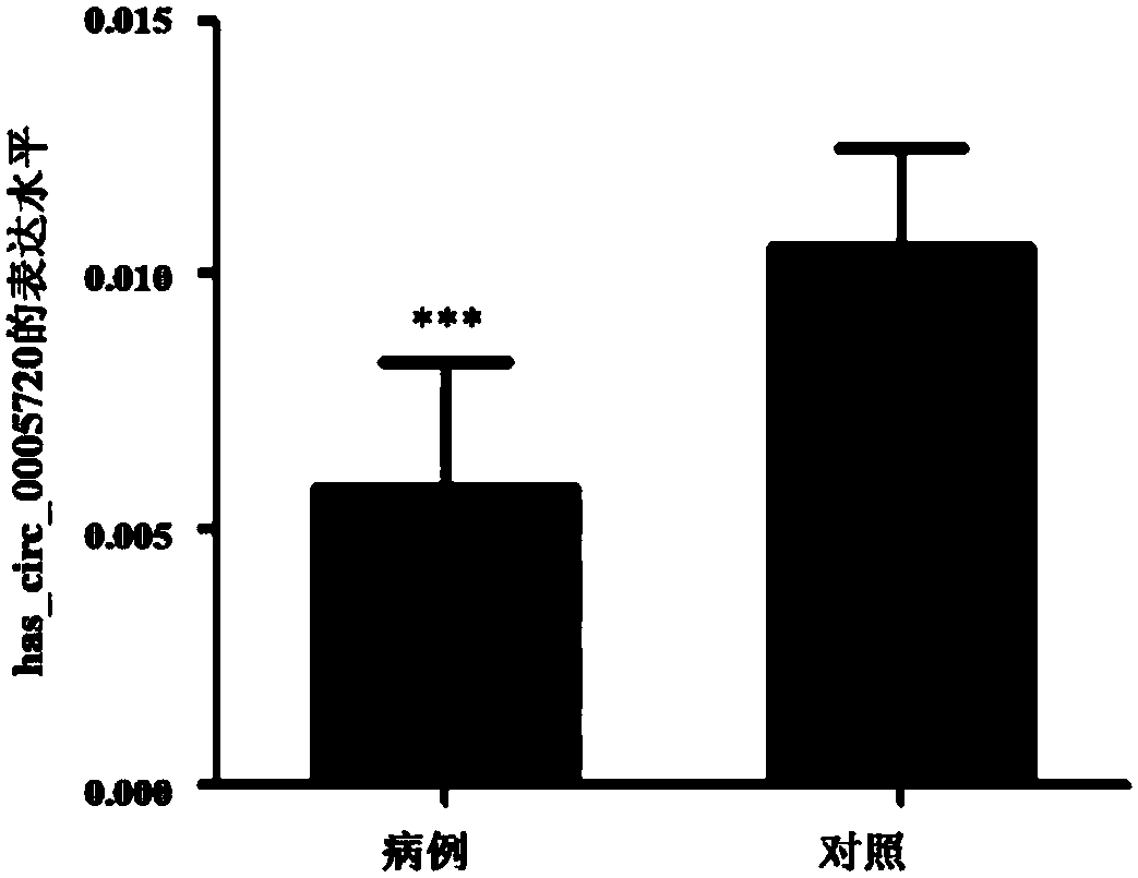 Group of circular RNA (circRNA) markers for diagnosis of childhood acute lymphoblastic leukemia (ALL) and application of group of circRNA markers for diagnosis of childhood ALL